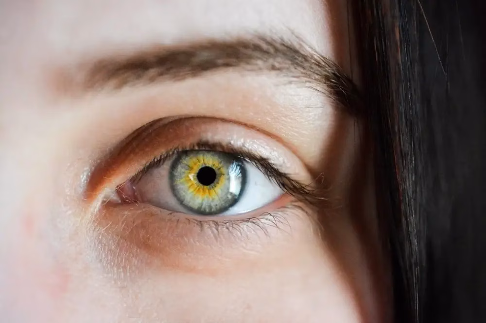 Lentes de Contacto: Olho Humano Lentes de Contacto: Olho Humano
